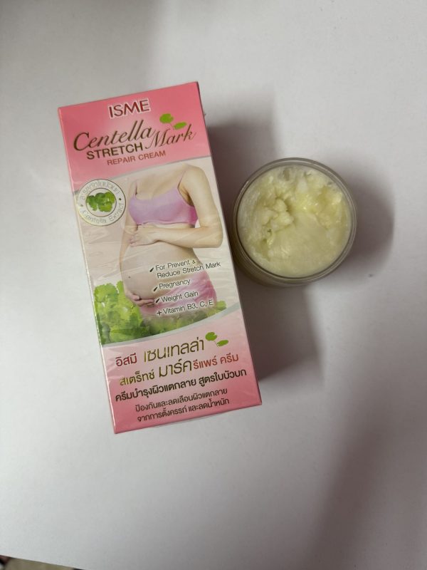 كريم لتشققات الجسم