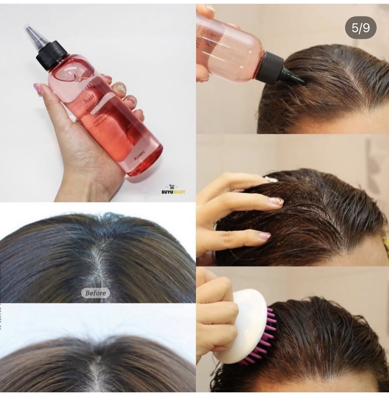 خل التوت للفروه لعلاج القشره ⬇️ - الصورة 5