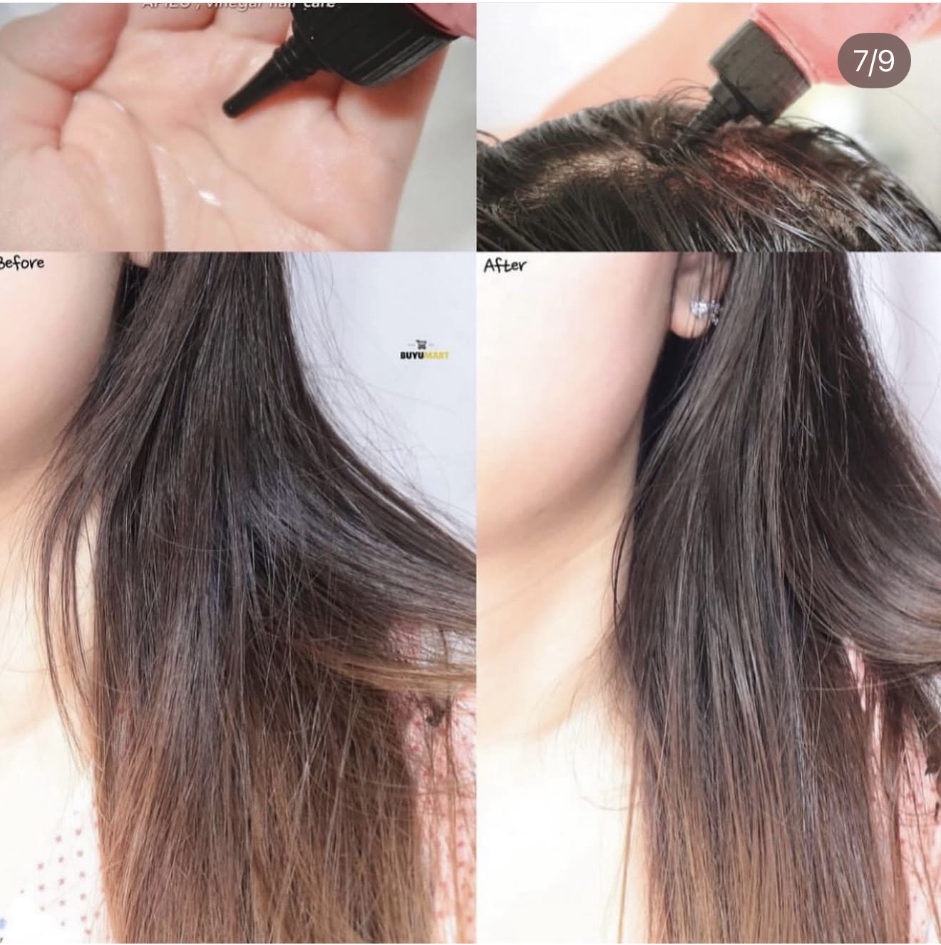 خل التوت للفروه لعلاج القشره ⬇️ - الصورة 7